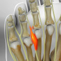 Expert Insights: Understanding and Treating Painful Foot Conditions