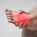 How to Identify and Treat Serious Foot Injuries