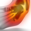 Understanding Foot and Ankle Injuries: An Expert's Perspective