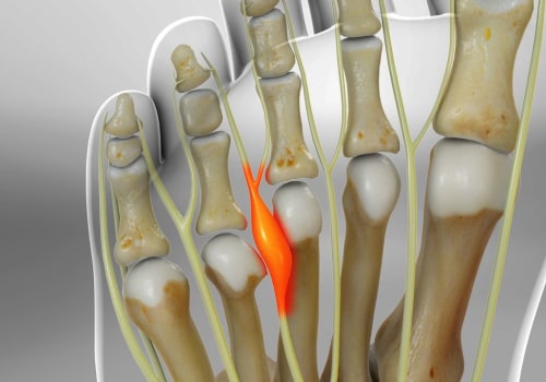 Expert Insights: Understanding and Treating Painful Foot Conditions