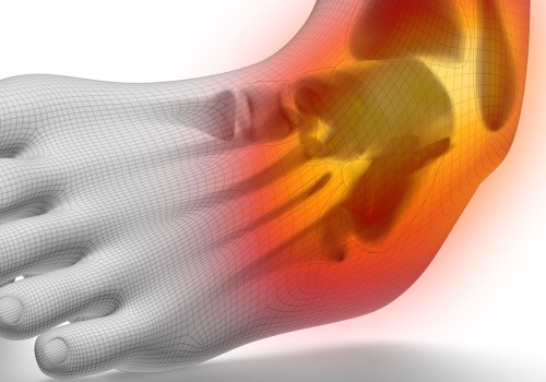 Understanding Foot and Ankle Injuries: An Expert's Perspective